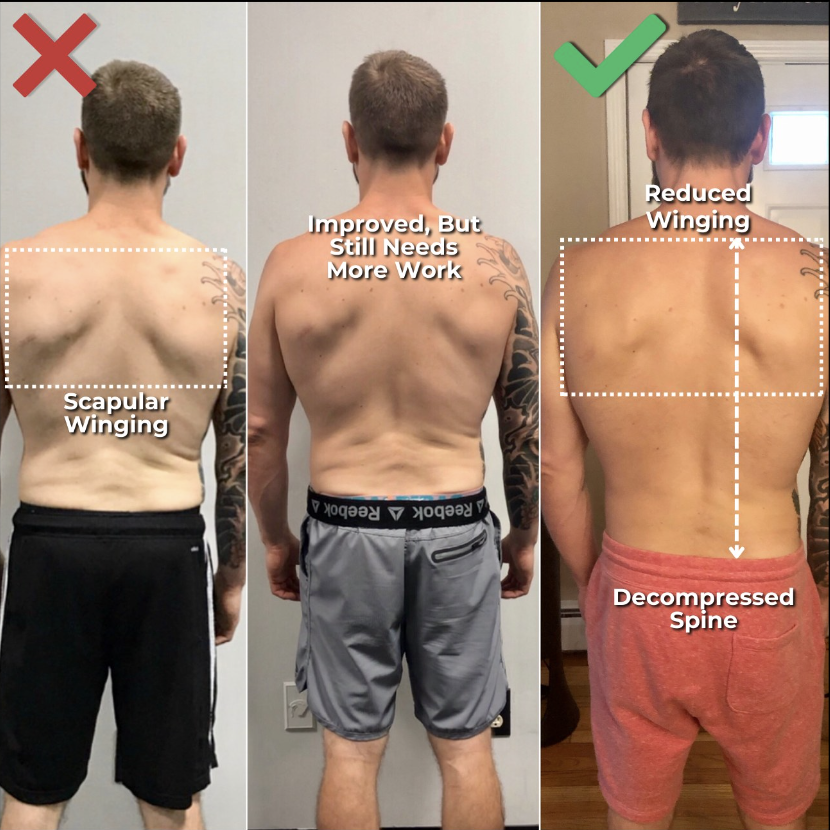 Back & posture, before and after