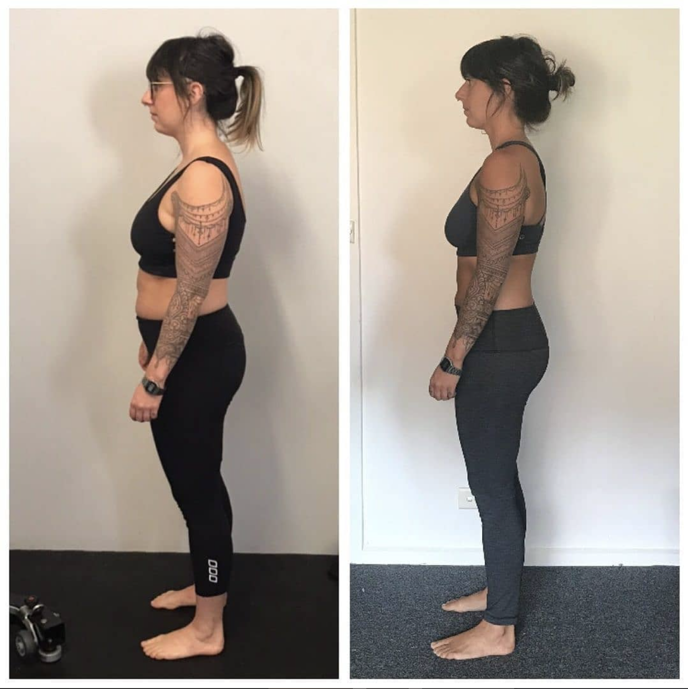 Discover the differences: physio vs Functional Patterns explained