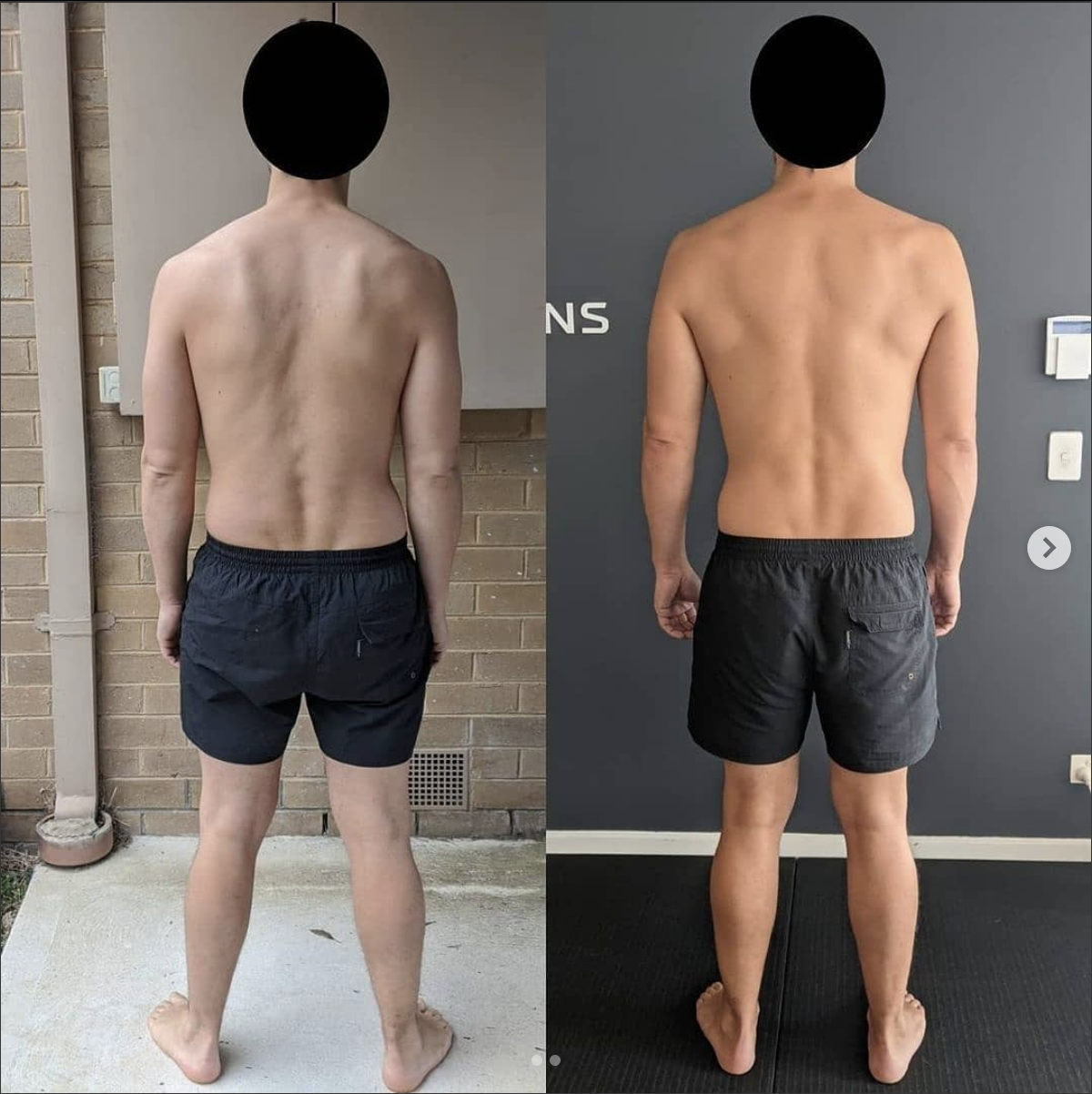 Chronic pain relief, before and after