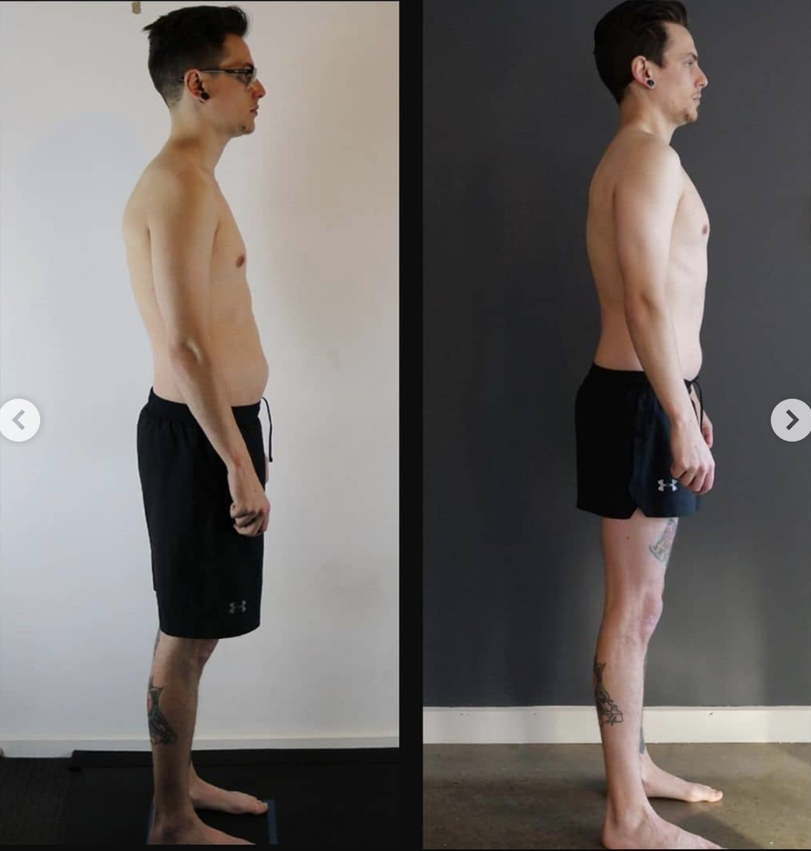 Fix rounded shoulders with Functional Patterns | Melbourne posture training
