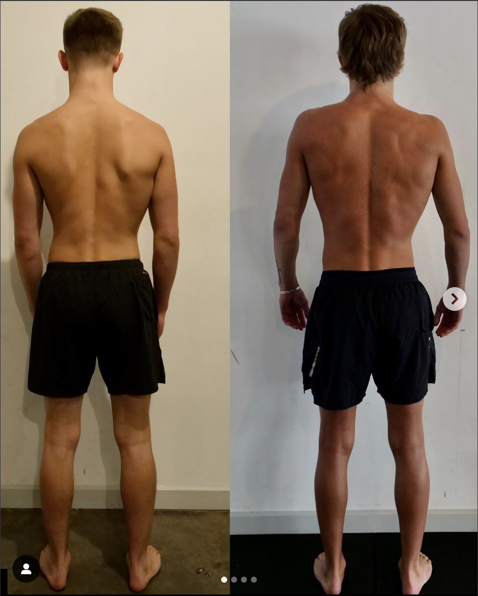 Looking for Melbourne’s top back specialist? See real results