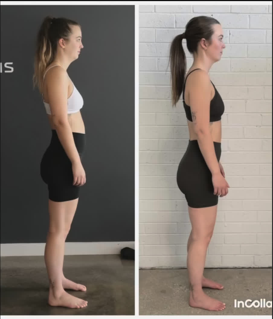 Unlock your best posture: effective back exercises for bad posture in Australia