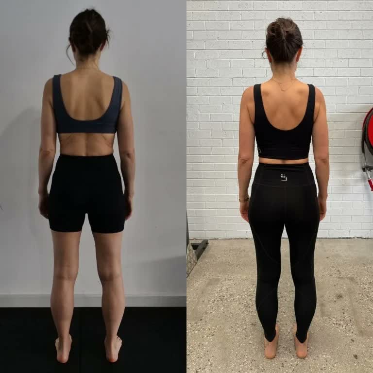 Correct shoulder blade pain and scapular winging