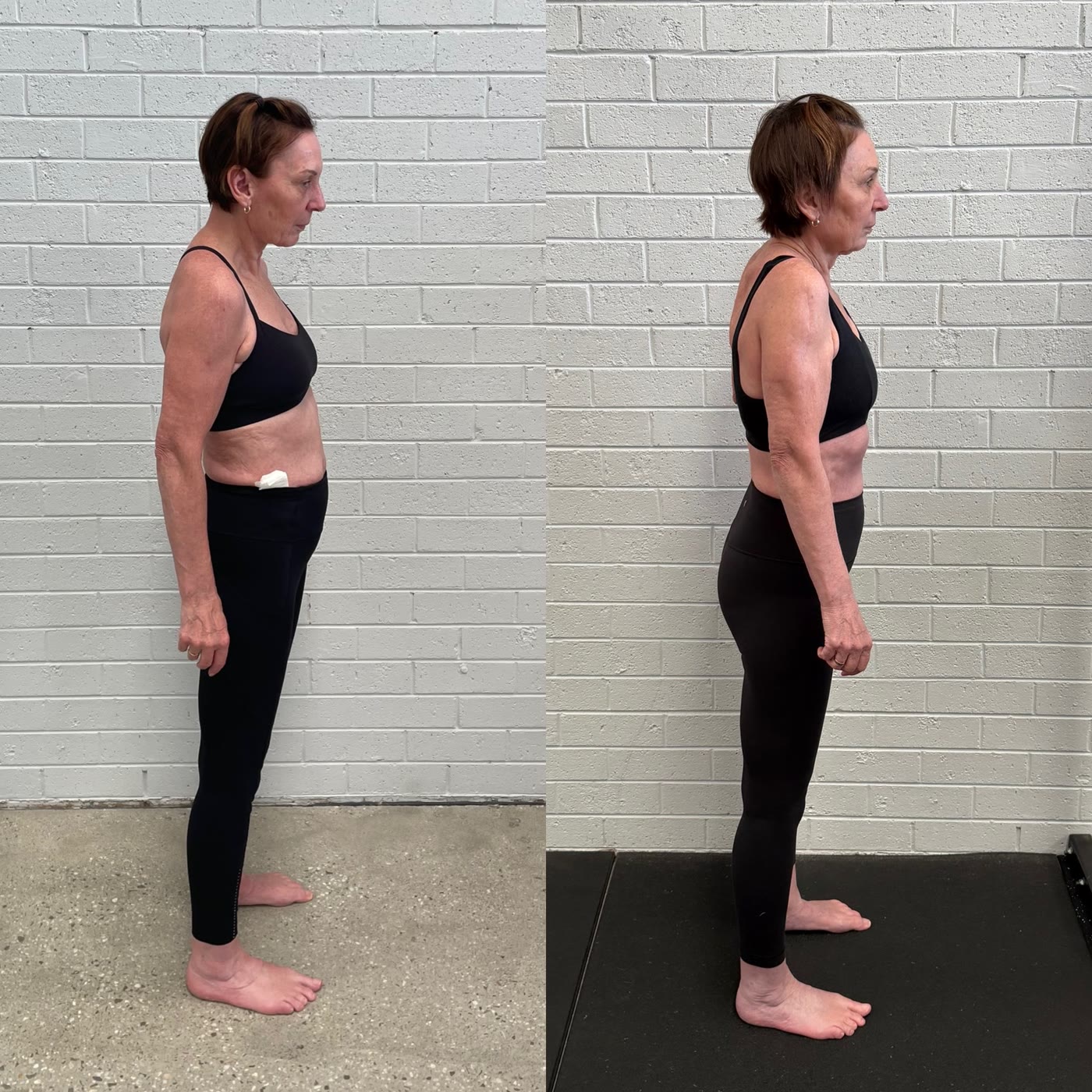 Julie, a more upright, decompressed standing posture.