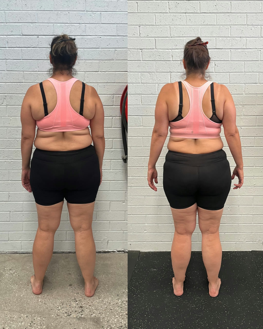 Tamara, improved back posture, symmetry and tone.